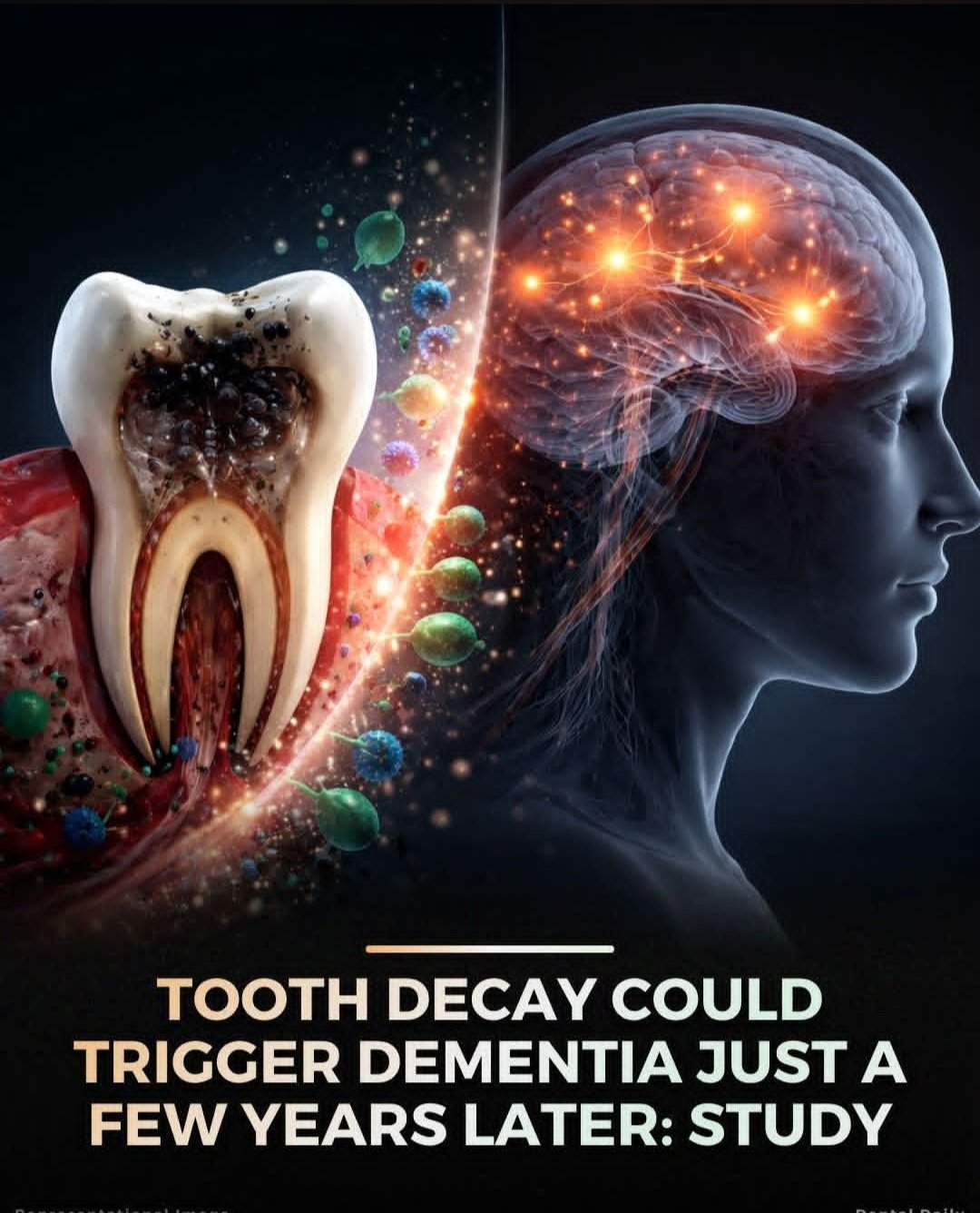 Tooth decay and brain health awareness